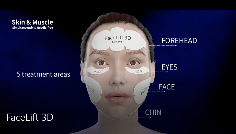 FaceLift 3D