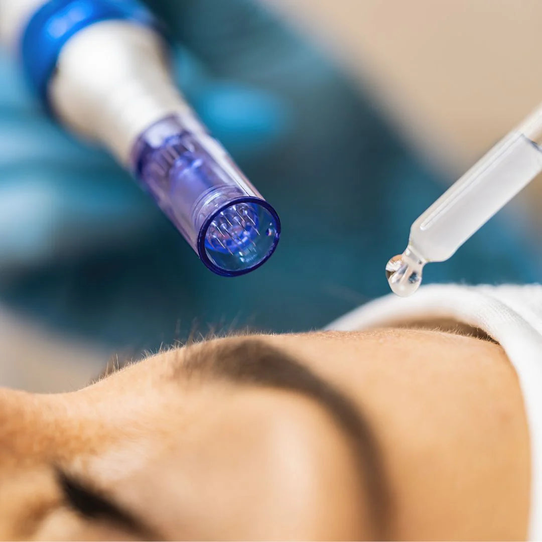 Mikroneedling Dermapen